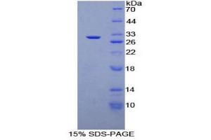 SDS-PAGE (SDS) image for CD1d Molecule (CD1D) (AA 64-298) protein (His tag) (ABIN2124365) (CD1d Protein (AA 64-298) (His tag))