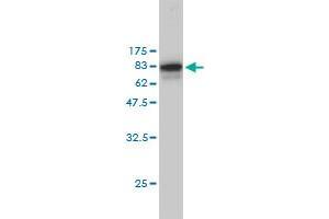 Western Blotting (WB) image for anti-Nucleophosmin (Nucleolar phosphoprotein B23, Numatrin) (NPM1) (AA 1-294) antibody (ABIN562035)