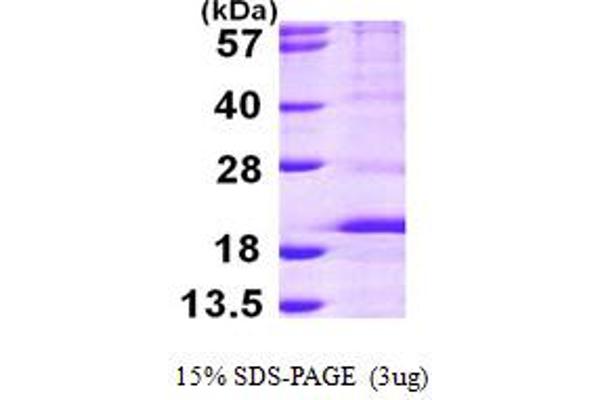 RPS14 Protein (AA 1-151) (His tag)