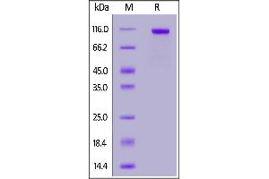 Biotinylated Human PTK7, His,Avitag on  under reducing (R) condition. (PTK7 Protein (AA 31-704) (His tag,AVI tag,Biotin))