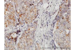 Immunostaining (ISt) image for anti-Dedicator of Cytokinesis 4 (DOCK4) (AA 1867-1966) antibody (ABIN564203)