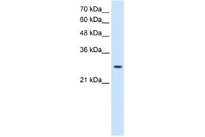 AK2 antibody used at 2. (Adenylate Kinase 2 抗体  (N-Term))