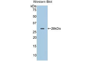 Detection of Recombinant CD40L, Porcine using Polyclonal Antibody to Cluster Of Differentiation 40 Ligand (CD40L) (CD40 Ligand 抗体  (AA 111-261))