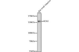 Western blot analysis of extracts of rat small intestine, using ROR2 antibody (ABIN7269889) at 1:1000 dilution. (ROR2 抗体  (AA 300-400))