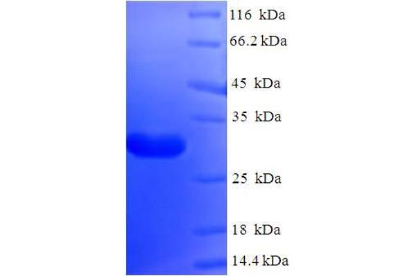 NANOS2 Protein (AA 1-138, full length) (His-SUMO Tag)