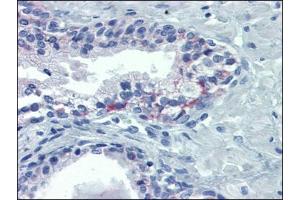 Human Prostate: Formalin-Fixed, Paraffin-Embedded (FFPE) (OR51E1 抗体)