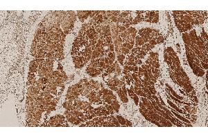 Human skeletal muscle: immunohistochemical staining of HAMLET: HAMLET: clone Ham1/7B6 (Dysferlin 抗体  (AA 1999-2016))