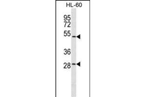 ZN Antibody (C-term) (ABIN1537399 and ABIN2849742) western blot analysis in HL-60 cell line lysates (35 μg/lane). (ZNF324 抗体  (C-Term))