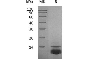 CXCL5 蛋白