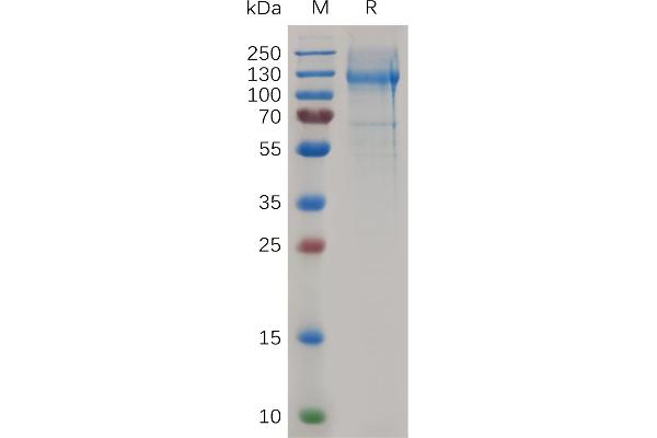 Nucleolin Protein (NCL) (AA 2-707) (His tag)