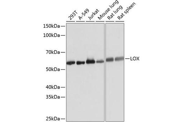 LOX 抗体