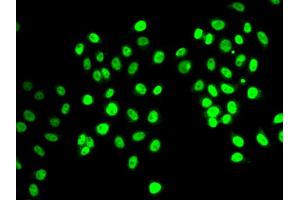 Immunofluorescence analysis of MCF-7 cells using REST antibody (ABIN6294168). (REST 抗体)