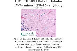 Image no. 3 for anti-Tubulin, beta 3 (TUBB3) (N-Term) antibody (ABIN1724161) (TUBB3 抗体  (N-Term))