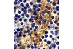 Immunohistochemistry (IHC) image for anti-CD209 (CD209) (C-Term) antibody (ABIN1030357) (DC-SIGN/CD209 抗体  (C-Term))