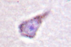 Image no. 2 for anti-Wiskott-Aldrich Syndrome (Eczema-thrombocytopenia) (WAS) antibody (ABIN272092) (WASP 抗体)