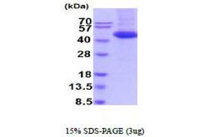 SDS-PAGE (SDS) image for Interleukin 4 (IL4) (AA 25-153) protein (ABIN7281150) (IL-4 Protein (AA 25-153))