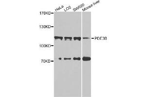 Western blot analysis of extracts of various cell lines, using PDE3B antibody. (PDE3B 抗体)