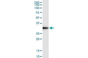 Immunoprecipitation of DNALI1 transfected lysate using rabbit polyclonal anti-DNALI1 and Protein A Magnetic Bead (DNALI1 (人) IP-WB Antibody Pair)