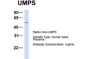 Host:  Rabbit  Target Name:  UMPS  Sample Type:  Human Adult Placenta  Antibody Dilution:  1. (UMPS 抗体  (C-Term))