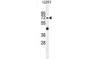 Western Blotting (WB) image for anti-GPI Anchor Attachment Protein 1 (GPAA1) antibody (ABIN2995802) (GPAA1 抗体)