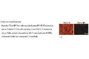 Immunohistochemistry (IHC) image for anti-Heparin-Binding EGF-Like Growth Factor (HBEGF) (Bound), (EGF Like Domain), (Soluble) antibody (ABIN3201018)