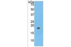 Western Blotting (WB) image for Carcinoembryonic Antigen Gene Family (CEA) ELISA Kit (ABIN6730886)