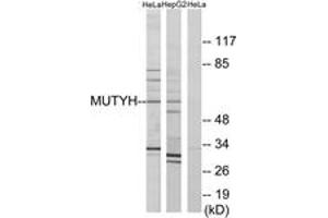 Western blot analysis of extracts from HeLa/HepG2 cells, using MUTYH Antibody. (MUTYH 抗体  (AA 151-200))