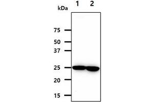 The cell lysates (40ug) were resolved by SDS-PAGE, transferred to PVDF membrane and probed with anti-human NNMT antibody (1:1000). (NNMT 抗体)