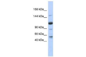 SR140 antibody used at 1 ug/ml to detect target protein. (SR140 抗体  (N-Term))