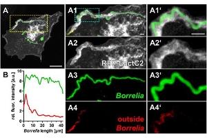 (A) Immunofluorescence micrographs of a primary macrophage expressing RFP–LactC2 (white), with internalized wild-type borreliae, stained by outside staining technique using Borrelia-specific antibody for antibody-accessible spirochetes (red), followed by permeabilization and staining of entire Borrelia cells. (Borrelia Burgdorferi 抗体)