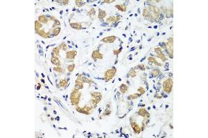 Immunohistochemistry of paraffin-embedded human stomach using OXCT1 antibody (ABIN5974499) at dilution of 1/100 (40x lens). (OXCT1 抗体)