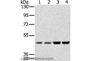 Western blot analysis of Hela, Raji, 231 and K562 cell, using SSB Polyclonal Antibody at dilution of 1:400 (SSB 抗体)