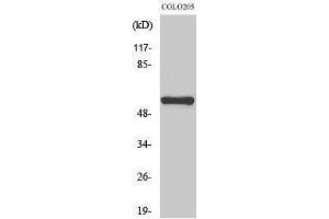 Western Blotting (WB) image for anti-Microphthalmia-Associated Transcription Factor (MITF) (Ser90) antibody (ABIN6281013) (MITF 抗体  (Ser90))