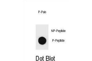 Dot blot analysis of Phospho-PTEN- Antibody Phospho-specific Pab (ABIN6241048 and ABIN6578934) on nitrocellulose membrane. (PTEN 抗体  (pSer294))