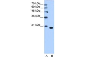 Western Blotting (WB) image for anti-Phosphatidylethanolamine Binding Protein 1 (PEBP1) antibody (ABIN2463157) (PEBP1 抗体)