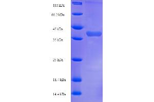 SDS-PAGE (SDS) image for Kallikrein 1-Related Peptidase B22 (KLK1B22) (AA 25-259) protein (His-SUMO Tag) (ABIN5710826) (Klk1b22 Protein (AA 25-259) (His-SUMO Tag))