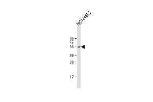 Anti-KRT36 Antibody (N-term) at 1:1000 dilution + NCI- whole cell lysate Lysates/proteins at 20 μg per lane. (Keratin 36 抗体  (N-Term))