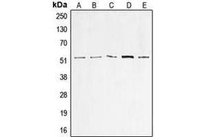 Western blot analysis of p53 expression in A549 (A), HeLa (B), HepG2 (C), MCF7 (D), A431 (E) whole cell lysates. (p53 抗体  (N-Term))