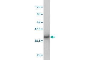 Western Blot detection against Immunogen (36. (MFRP 抗体  (AA 480-579))