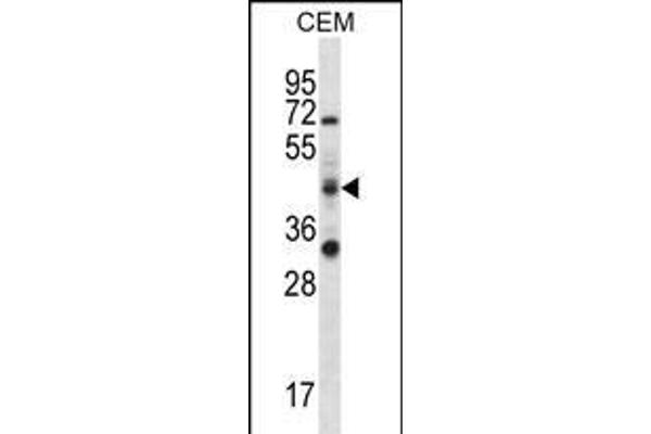 RBM42 抗体  (C-Term)