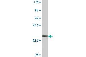 Western Blot detection against Immunogen (36. (HSD17B1 抗体  (AA 189-285))