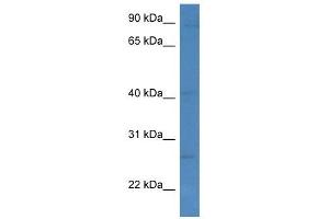 Western Blot showing KLRC1 antibody used at a concentration of 1 ug/ml against MCF7 Cell Lysate (KLRC1 抗体  (C-Term))