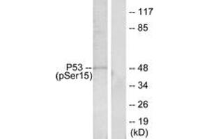 Western Blotting (WB) image for anti-Tumor Protein P53 (TP53) (pSer15) antibody (ABIN2888497) (p53 抗体  (pSer15))