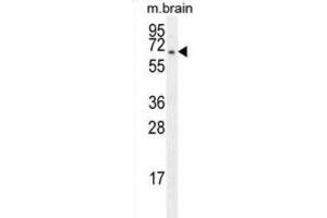 Western Blotting (WB) image for anti-F-Box Protein 21 (FBXO21) antibody (ABIN2996140) (FBXO21 抗体)