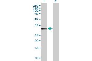 Western Blot analysis of BCL11A expression in transfected 293T cell line by BCL11A MaxPab polyclonal antibody. (BCL11A 抗体  (AA 1-243))