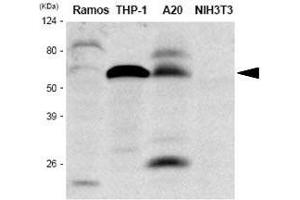 Western Blotting (WB) image for anti-Interferon Regulatory Factor 5 (IRF5) antibody (ABIN2475143) (IRF5 抗体)