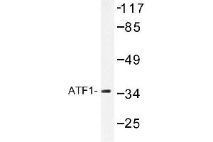 Image no. 1 for anti-Activating Transcription Factor 1 (AFT1) antibody (ABIN272179) (AFT1 抗体)