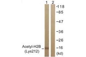 Western Blotting (WB) image for anti-Histone H2B (acLys12) antibody (ABIN2890727) (Histone H2B 抗体  (acLys12))