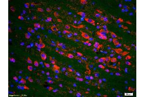 Formalin-fixed and paraffin-embedded rat brain labeled with Anti-phospho-P53(Ser20) Polyclonal Antibody, Unconjugated (ABIN702895) 1:200, overnight at 4°C, The secondary antibody was Goat Anti-Rabbit IgG, Cy3 conjugated used at 1:200 dilution for 40 minutes at 37°C. (p53 抗体  (pSer20))