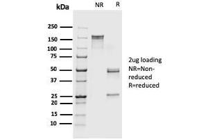 SDS-PAGE (SDS) image for anti-S100 Calcium Binding Protein A4 (S100A4) (AA 1-200) antibody (ABIN6940544)